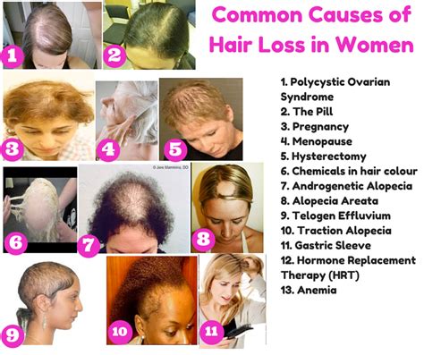 Hair Loss Causes hairstyles