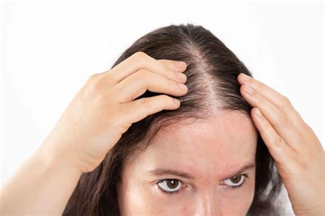 Thinning Hair Solutions hair