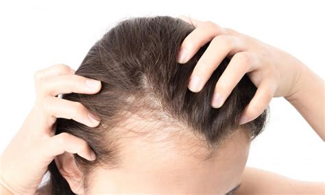 Thinning Hair Solutions hairstyles